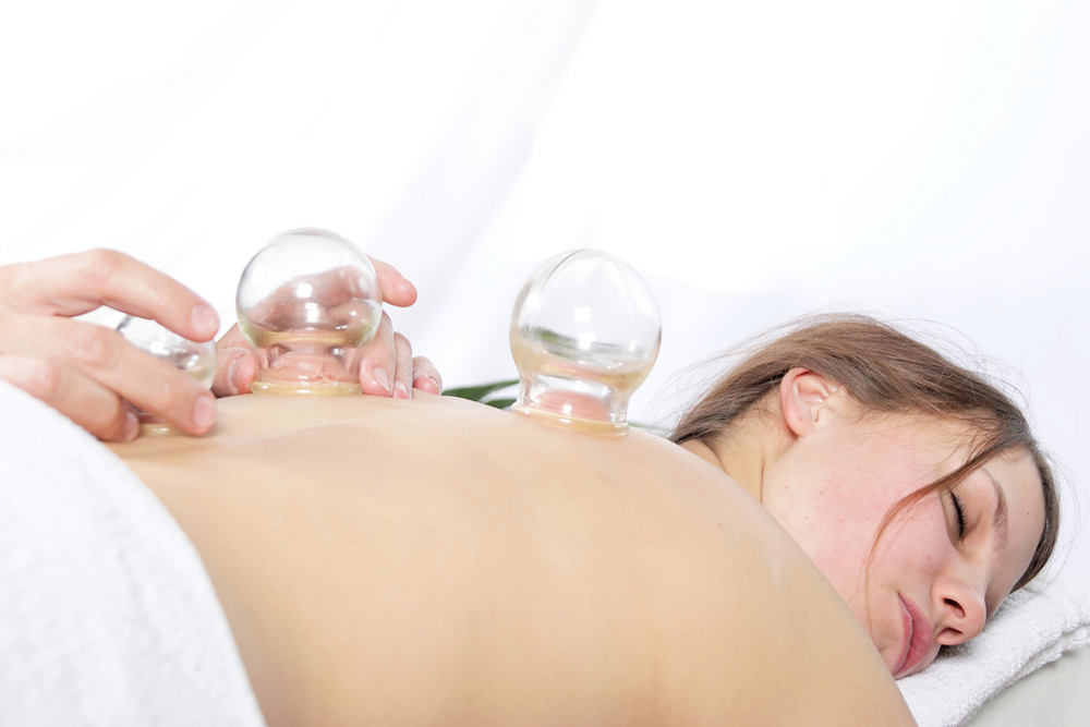 Does Cupping Therapy Help Relieve Pain Naturally